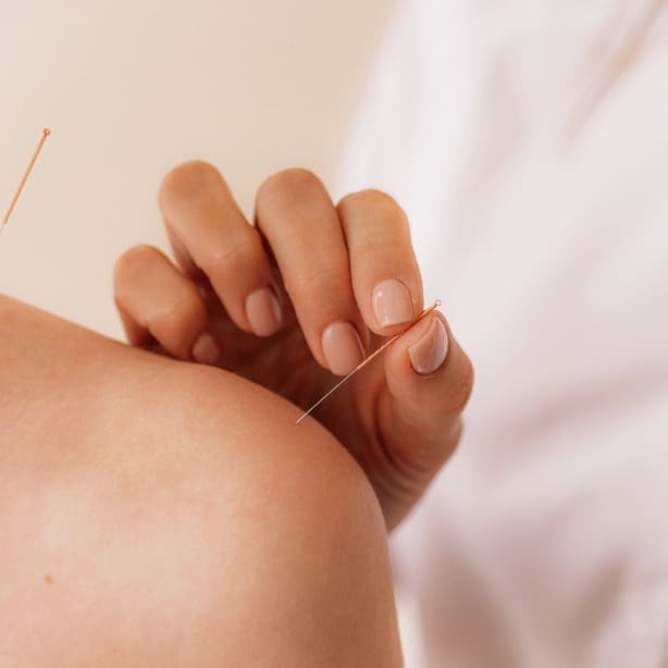 Fine needle placed in a patient's shoulder