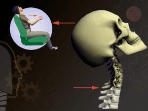 Diagram of the head forced back over the head restraint 150 milliseconds after impact